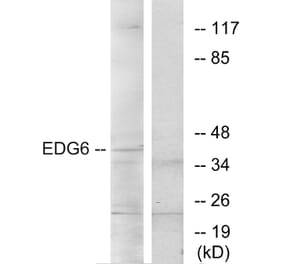 Western Blot - Anti-EDG6 Antibody (G087) - Antibodies.com