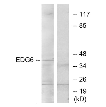 Western Blot - Anti-EDG6 Antibody (G087) - Antibodies.com