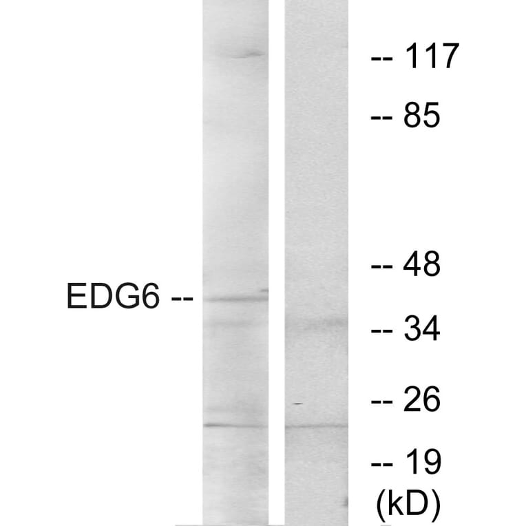 Western Blot - Anti-EDG6 Antibody (G087) - Antibodies.com