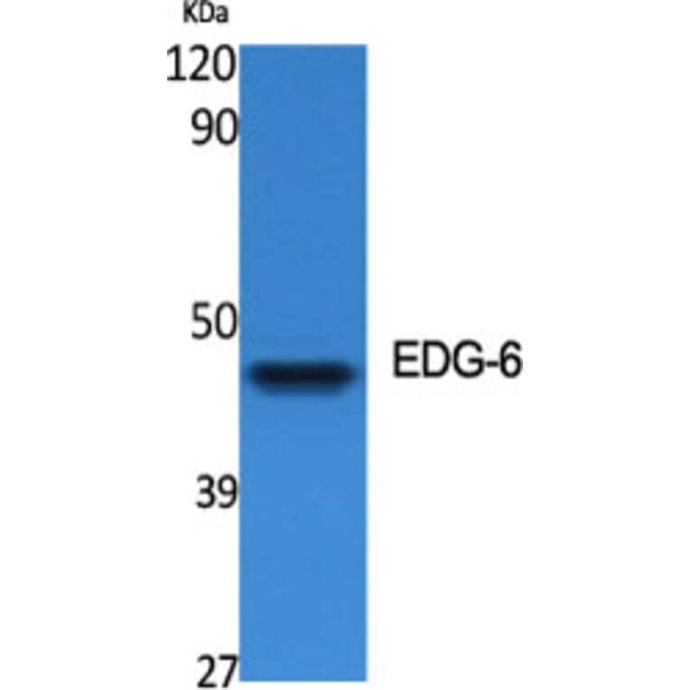 Western Blot - Anti-EDG6 Antibody (G087) - Antibodies.com