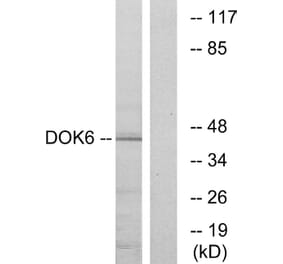 Western Blot - Anti-DOK6 Antibody (C11230) - Antibodies.com