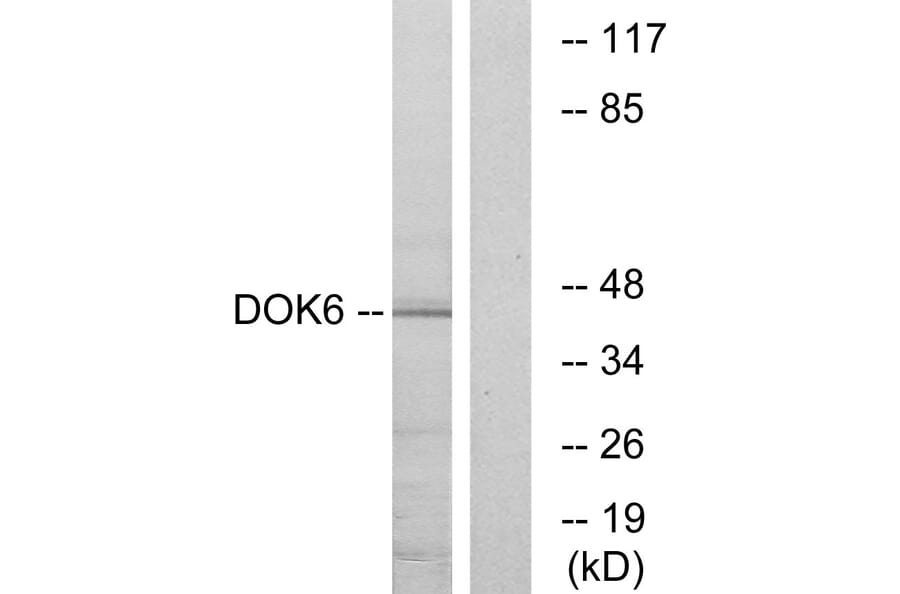 Western Blot - Anti-DOK6 Antibody (C11230) - Antibodies.com
