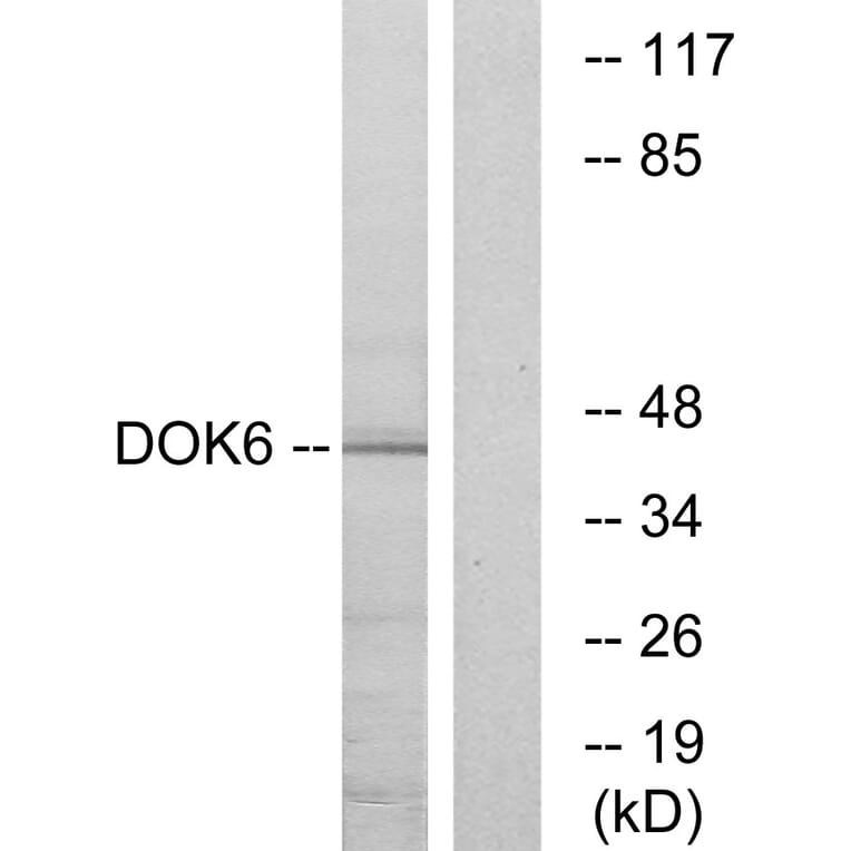 Western Blot - Anti-DOK6 Antibody (C11230) - Antibodies.com