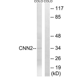 Western Blot - Anti-CNN2 Antibody (C14881) - Antibodies.com