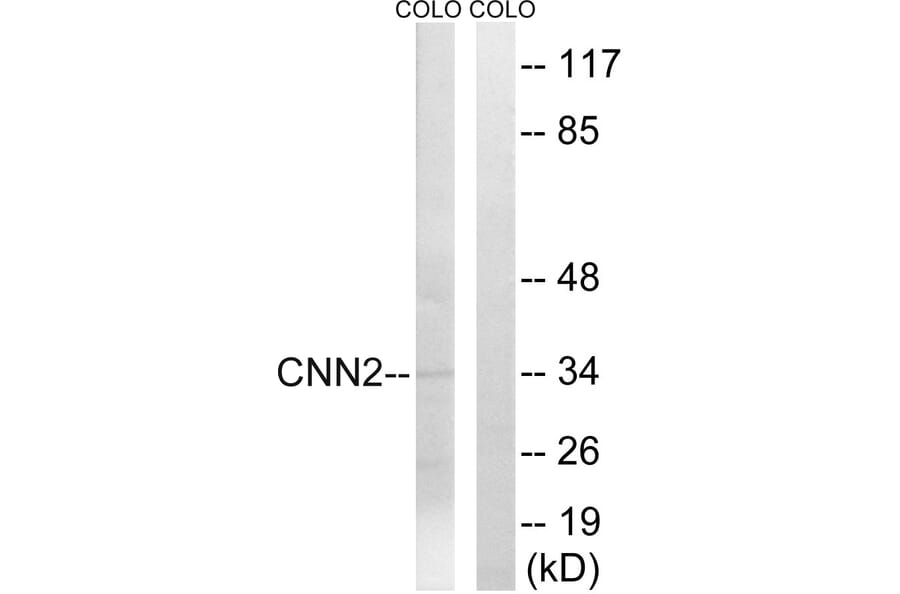 Western Blot - Anti-CNN2 Antibody (C14881) - Antibodies.com