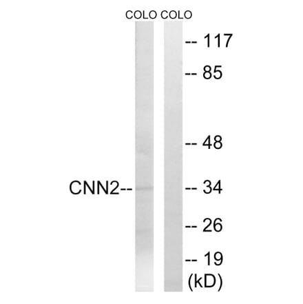 Western Blot - Anti-CNN2 Antibody (C14881) - Antibodies.com