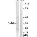 Western Blot - Anti-CNN2 Antibody (C14881) - Antibodies.com