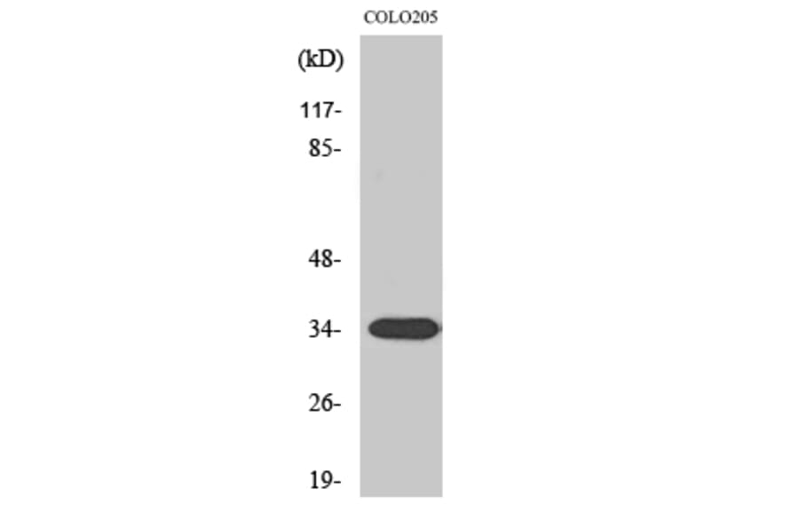 Western Blot - Anti-CNN2 Antibody (C14881) - Antibodies.com