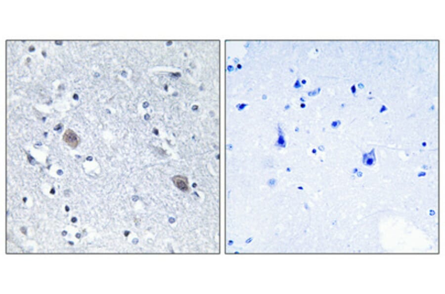 Immunohistochemistry - Anti-CNN2 Antibody (C14881) - Antibodies.com