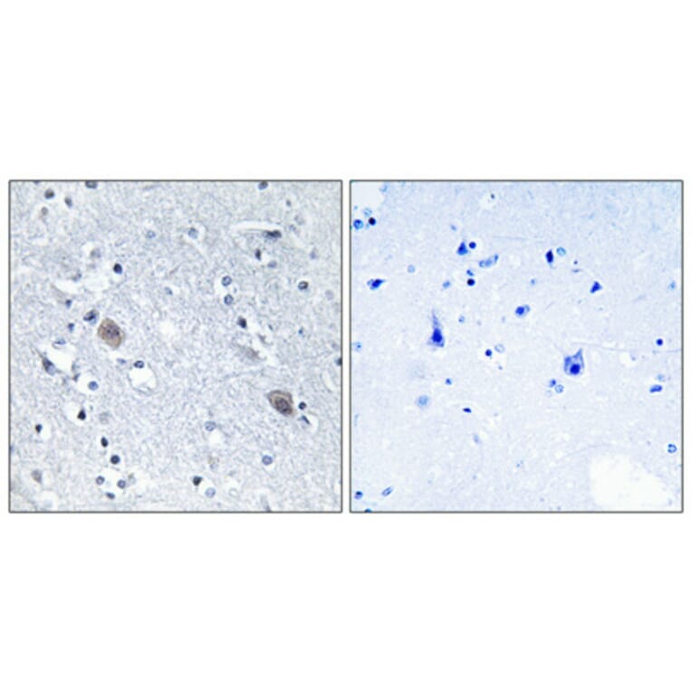 Immunohistochemistry - Anti-CNN2 Antibody (C14881) - Antibodies.com