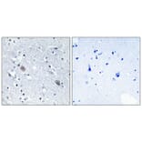 Immunohistochemistry - Anti-CNN2 Antibody (C14881) - Antibodies.com