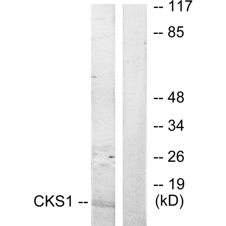 Western Blot - Anti-CKS1 Antibody (C10766) - Antibodies.com