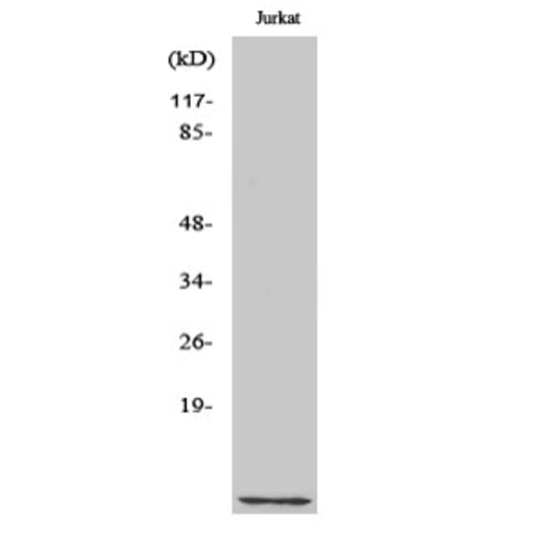 Western Blot - Anti-CKS1 Antibody (C10766) - Antibodies.com