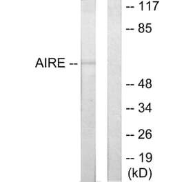 Western Blot - Anti-AIRE Antibody (C10123) - Antibodies.com