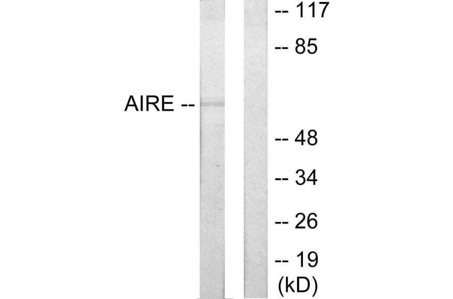 Western Blot - Anti-AIRE Antibody (C10123) - Antibodies.com
