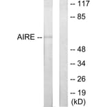 Western Blot - Anti-AIRE Antibody (C10123) - Antibodies.com