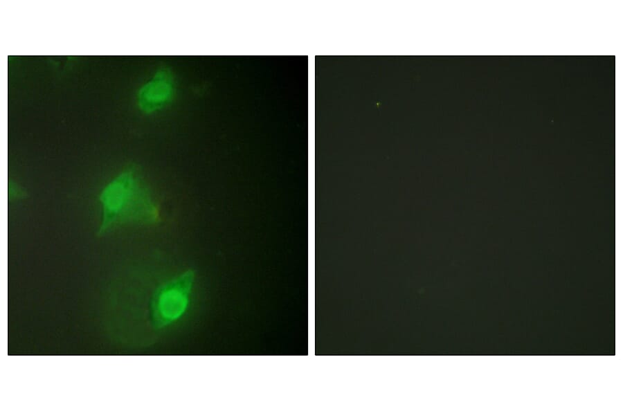 Immunofluorescence - Anti-AIRE Antibody (C10123) - Antibodies.com