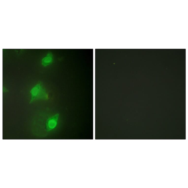 Immunofluorescence - Anti-AIRE Antibody (C10123) - Antibodies.com