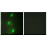 Immunofluorescence - Anti-AIRE Antibody (C10123) - Antibodies.com