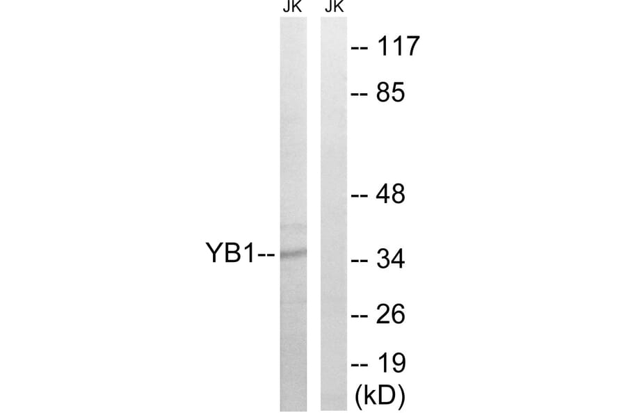 Western Blot - Anti-YB1 Antibody (B8481) - Antibodies.com