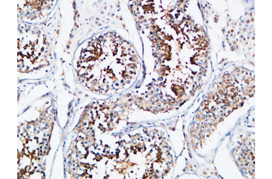 Immunohistochemistry - Anti-YB1 Antibody (B8481) - Antibodies.com