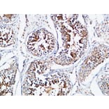Immunohistochemistry - Anti-YB1 Antibody (B8481) - Antibodies.com