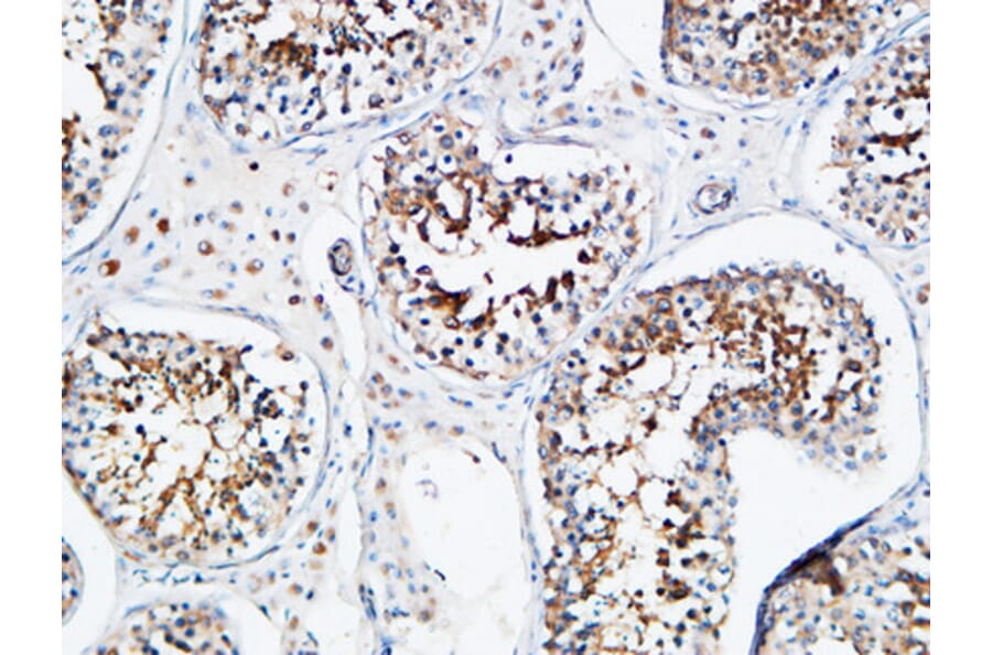 Immunohistochemistry - Anti-YB1 Antibody (B8481) - Antibodies.com