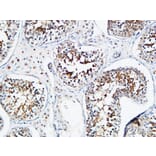 Immunohistochemistry - Anti-YB1 Antibody (B8481) - Antibodies.com