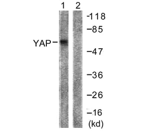Western Blot - Anti-YAP Antibody (B0757) - Antibodies.com