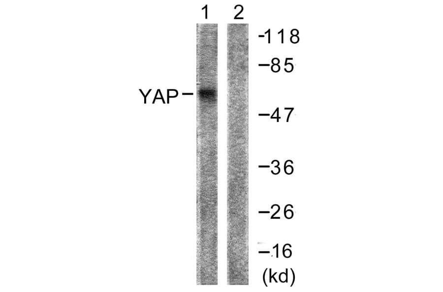 Western Blot - Anti-YAP Antibody (B0757) - Antibodies.com