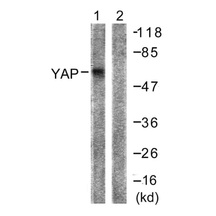 Western Blot - Anti-YAP Antibody (B0757) - Antibodies.com