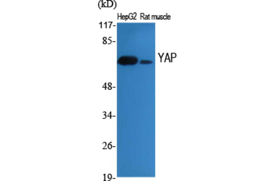 Western Blot - Anti-YAP Antibody (B0757) - Antibodies.com