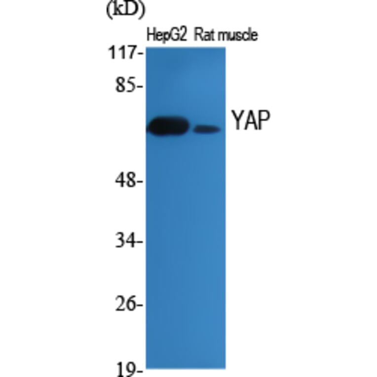 Western Blot - Anti-YAP Antibody (B0757) - Antibodies.com