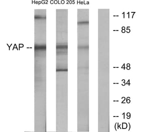 Western Blot - Anti-YAP Antibody (C10630) - Antibodies.com
