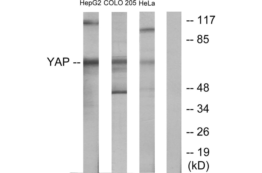 Western Blot - Anti-YAP Antibody (C10630) - Antibodies.com