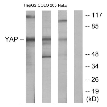Western Blot - Anti-YAP Antibody (C10630) - Antibodies.com