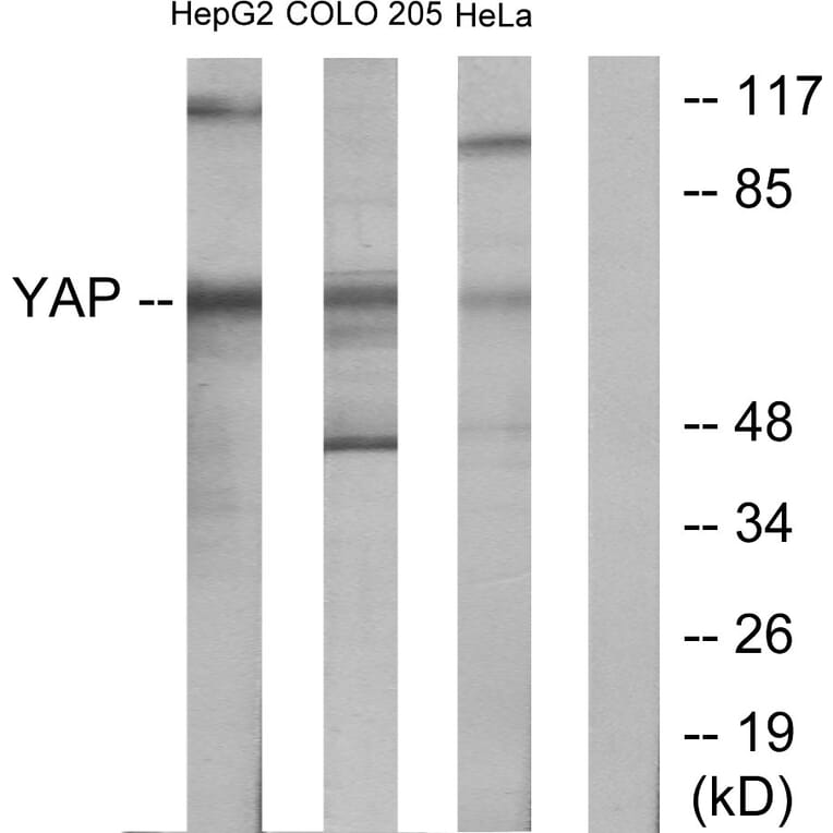 Western Blot - Anti-YAP Antibody (C10630) - Antibodies.com