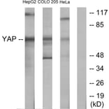 Western Blot - Anti-YAP Antibody (C10630) - Antibodies.com