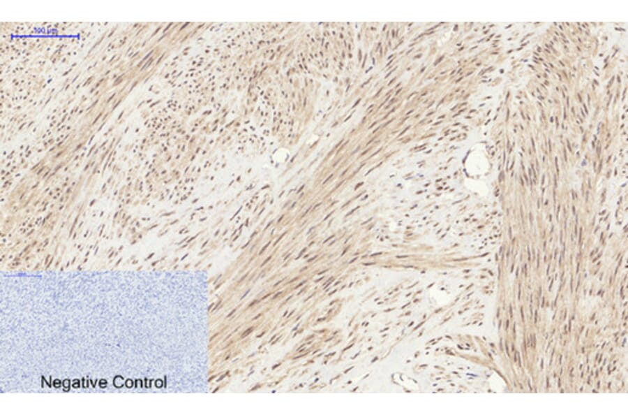 Immunohistochemistry - Anti-YAP Antibody (C10630) - Antibodies.com
