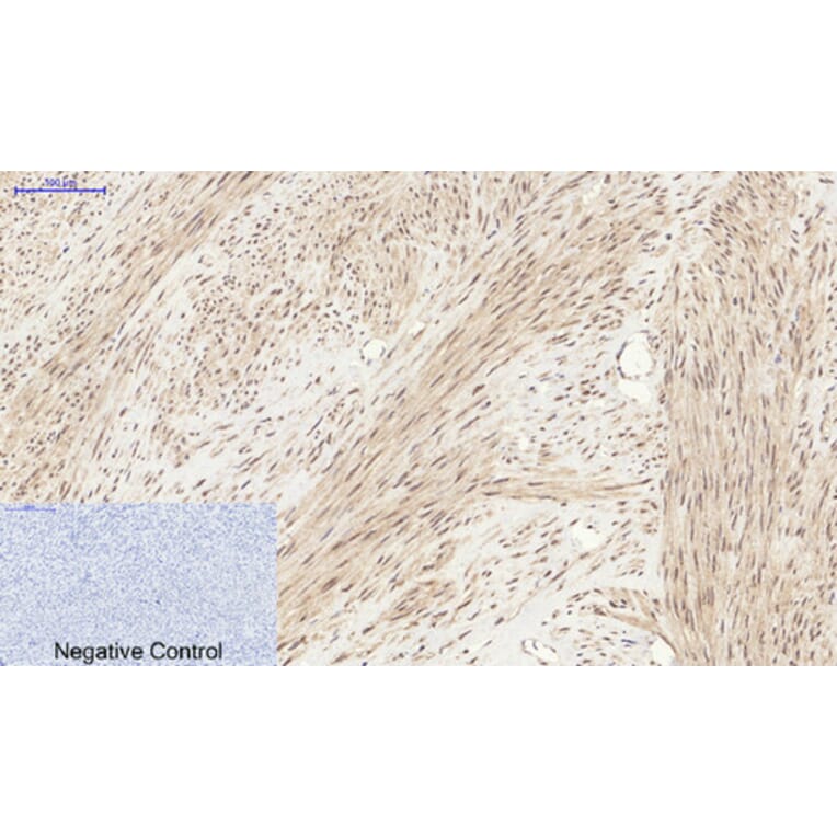 Immunohistochemistry - Anti-YAP Antibody (C10630) - Antibodies.com