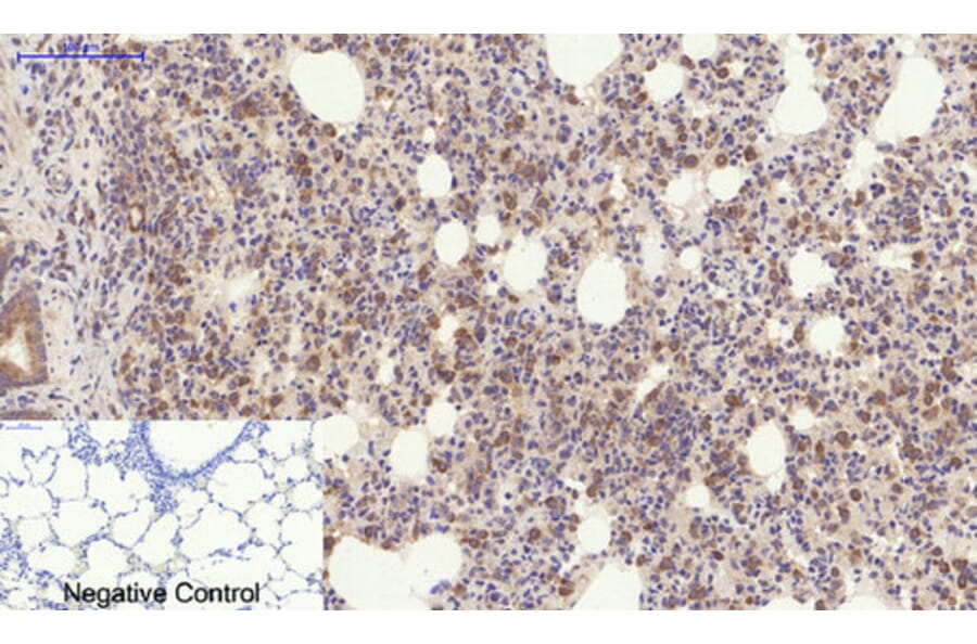 Immunohistochemistry - Anti-YAP Antibody (C10630) - Antibodies.com