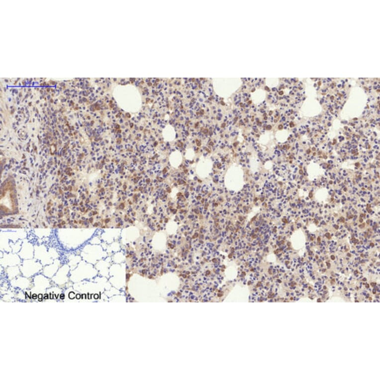 Immunohistochemistry - Anti-YAP Antibody (C10630) - Antibodies.com