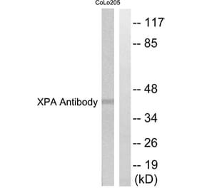 Western Blot - Anti-XPA Antibody (C0393) - Antibodies.com