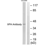 Western Blot - Anti-XPA Antibody (C0393) - Antibodies.com