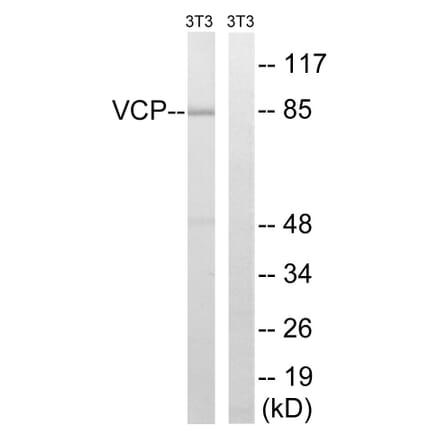 Western Blot - Anti-VCP Antibody (B8449) - Antibodies.com