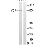 Western Blot - Anti-VCP Antibody (B8449) - Antibodies.com