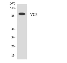 Western Blot - Anti-VCP Antibody (R12-3676) - Antibodies.com