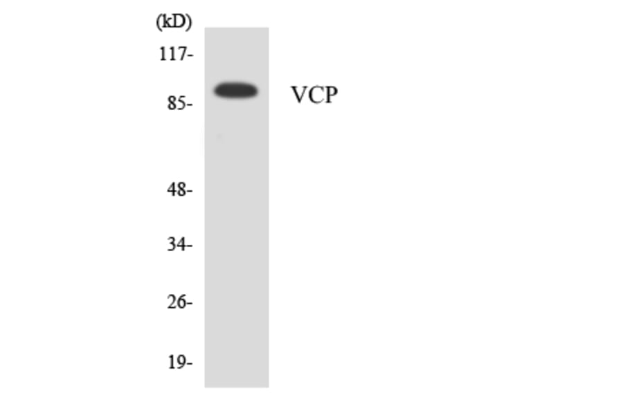 Western Blot - Anti-VCP Antibody (R12-3676) - Antibodies.com