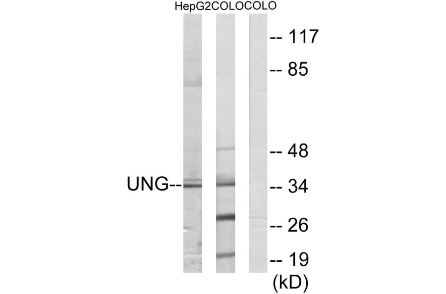 Western Blot - Anti-UNG Antibody (C10355) - Antibodies.com