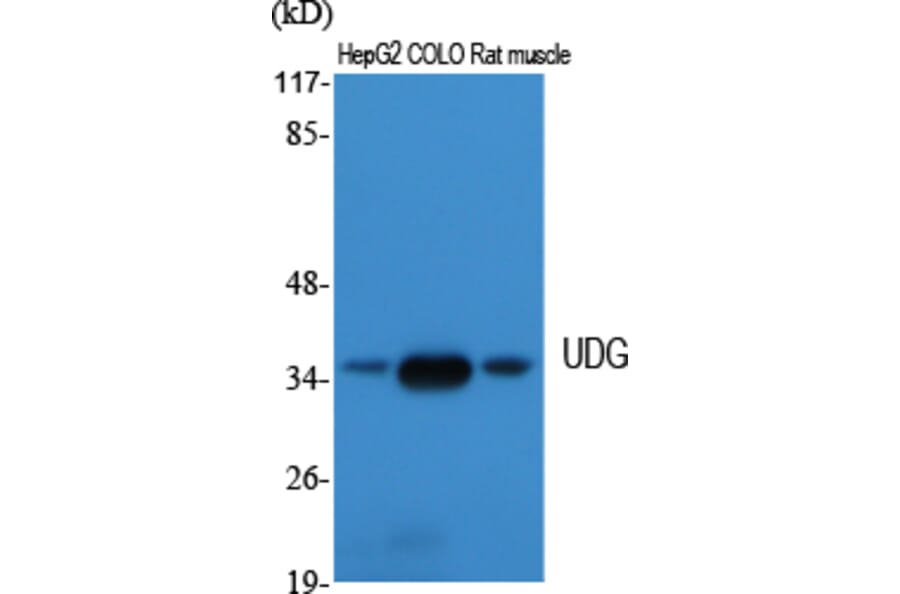 Western Blot - Anti-UNG Antibody (C10355) - Antibodies.com